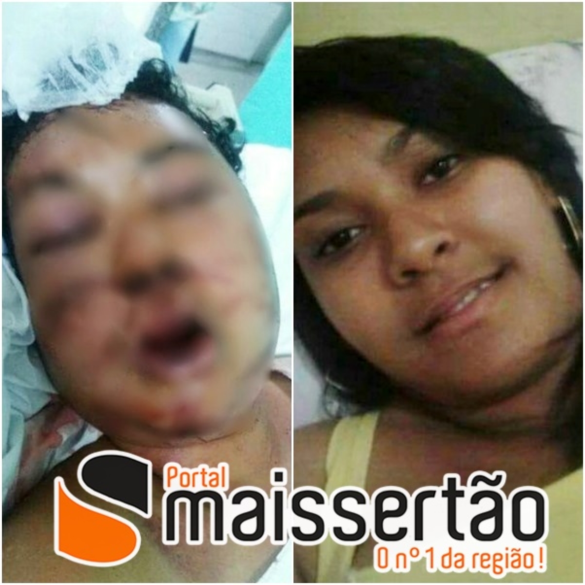 Gloriense é agredida a pedradas e é socorrida em estado grave com rosto desfigurado (Imagem: Portal Mais Sertão)