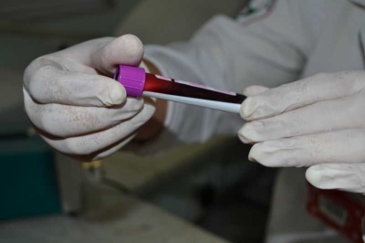 Doação de medula: cadastro de doadores é único e permanente (Imagem: SES/SE)