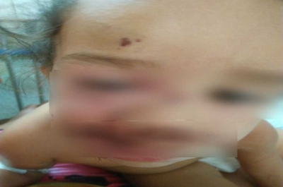 Criança foi atacada pelo pitbull em sua casa, no Augusto Franco (Foto: Arquivo Familiar)