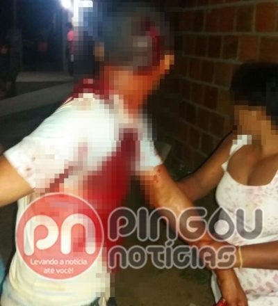 Briga entre vizinhos termina com uma pessoa ferida no Alto Sertão (Foto: Pingou Notícias)