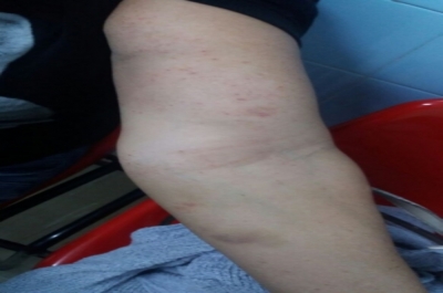   Cemar do Augusto Franco disponibiliza tratamento para pessoas alérgicas (Foto: SMS)