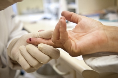 Teste da aids (Foto: Arquivo Agência Brasil)