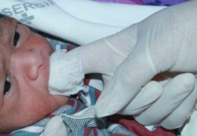 �? preciso higienizar a cavidade bucal do bebê após a amamentação (Foto: SES/SE)