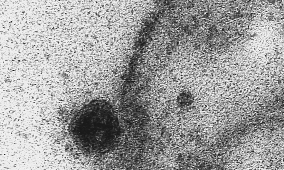 USP: novo coronavírus infecta e se replica em glândulas salivares (Foto: Débora Barreto/ Fiocruz)