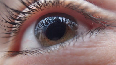 Ceratocone: conheça a doença ocular que pode levar a um transplante de córneas (Foto: Assessoria Unimed Sergipe | AG�? - Comunicação Estratégica)