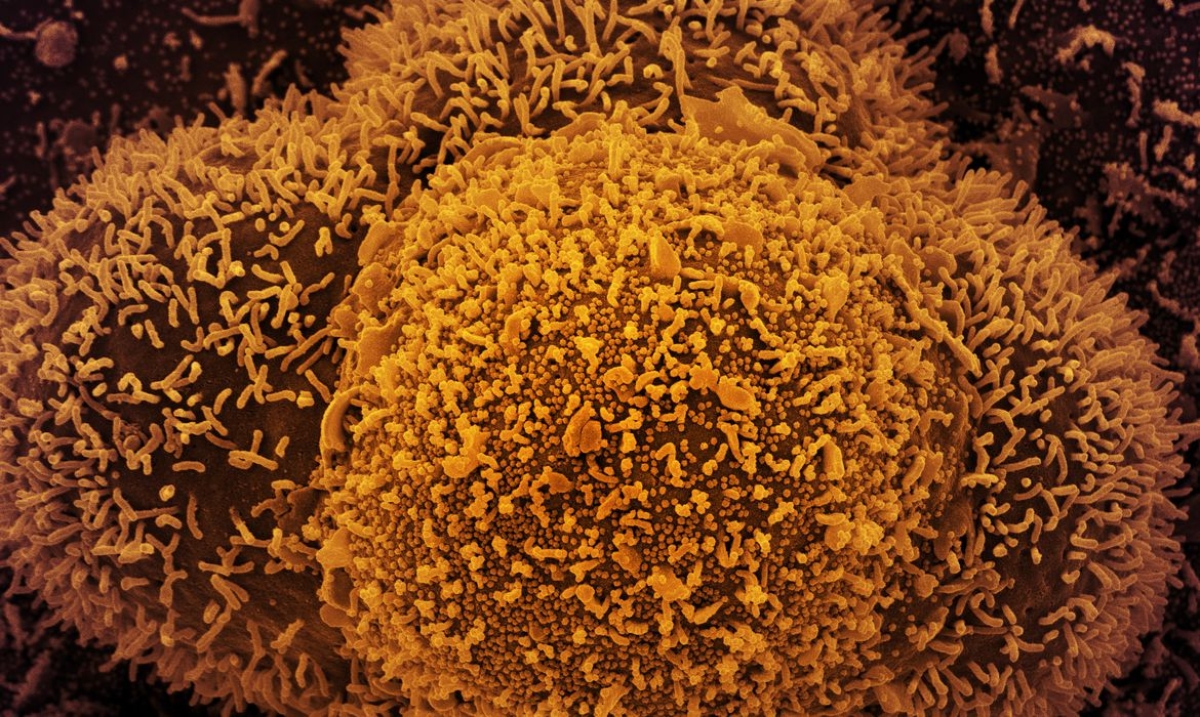 �?micron: Brasil tem 19 casos confirmados e investiga sete (Foto: NIAID)