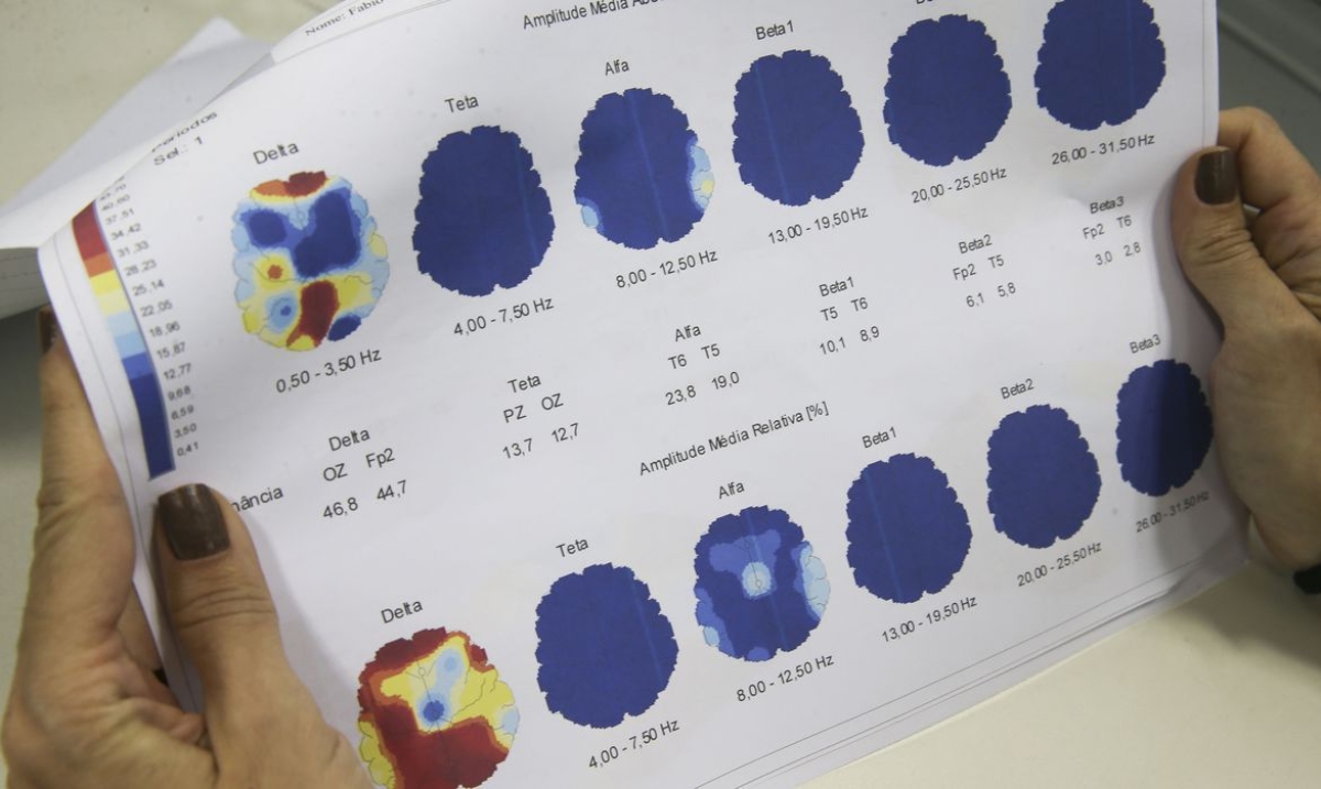 Março Roxo quer conscientizar população sobre a epilepsia (Foto: Marcello Casal Jr./ Agência Brasil)