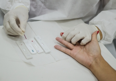 Saúde de Sergipe disponibilizará testagem para HIV, Sífilis e Hepatites virais neste sábado, 30/7 - Foto: Flávia Pacheco | Ascom SES/SE