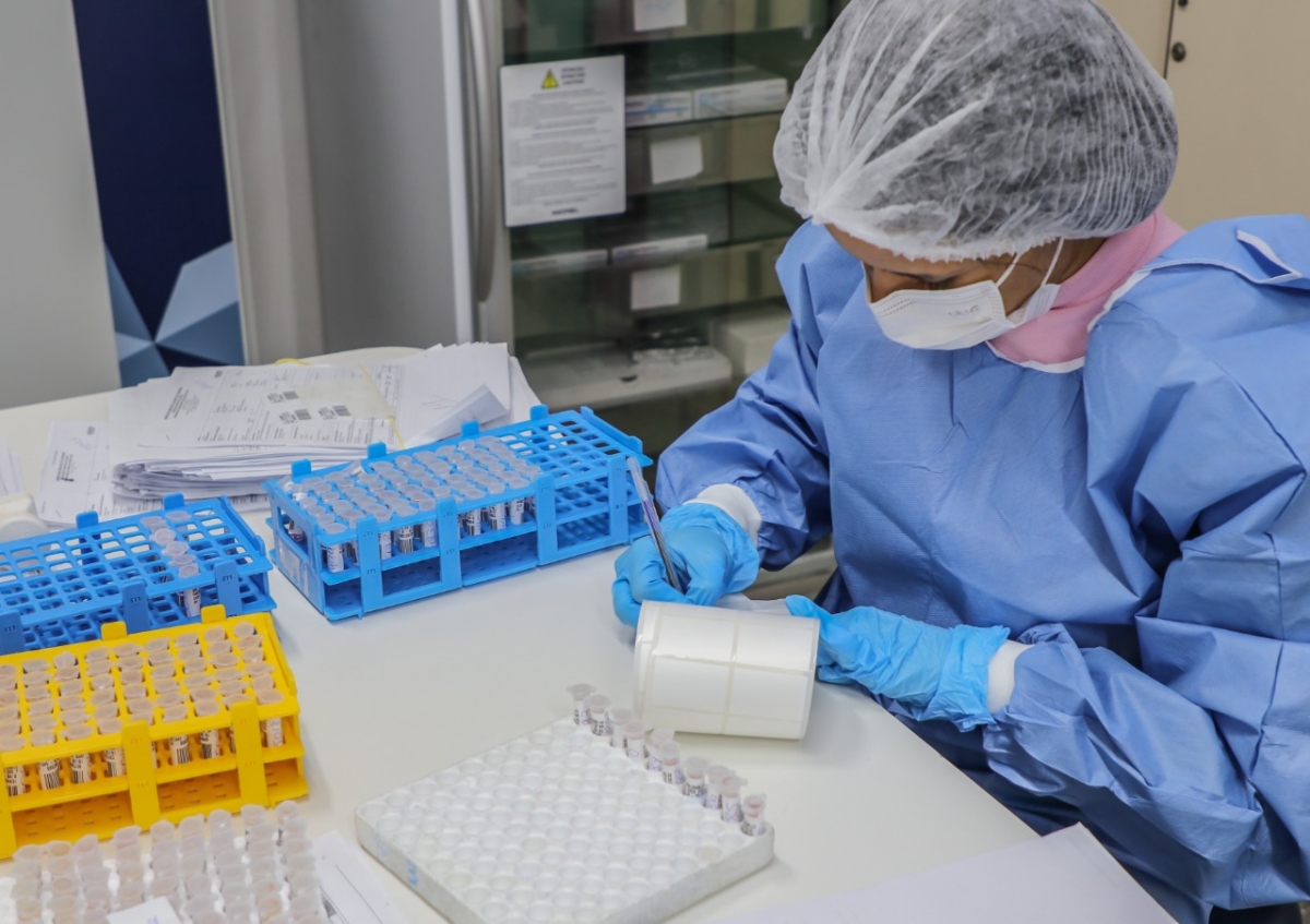 Laboratório Central de Saúde de Sergipe (Lacen) passa a  analisar testes para detecção da Monkeypox - Foto: Ascom SES/SE