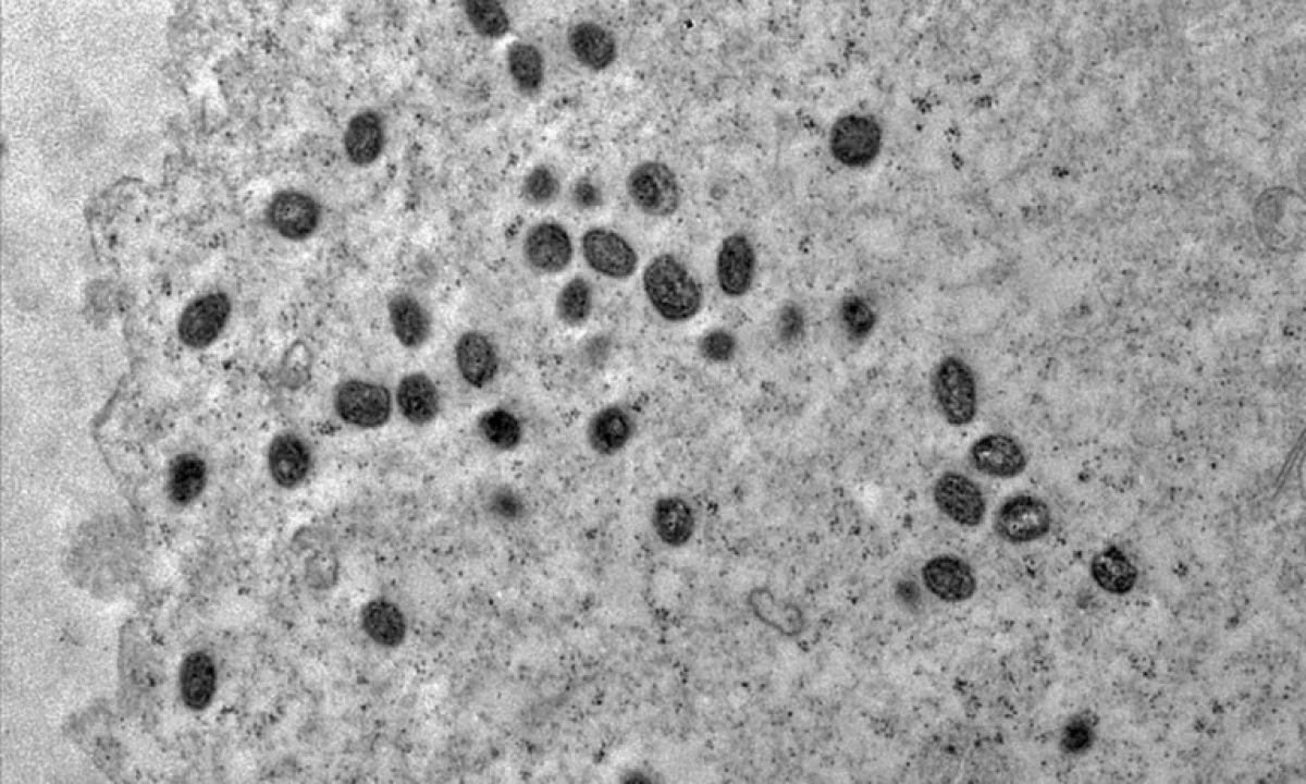 Mpox - Foto: Débora F. Barreto-Vieira / IOC / Fiocruz
