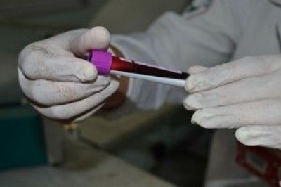 Durante o cadastro de medula  coletado uma amostra com 5ml de sangue para realizao do exame de HLA (Foto: SES/SE)